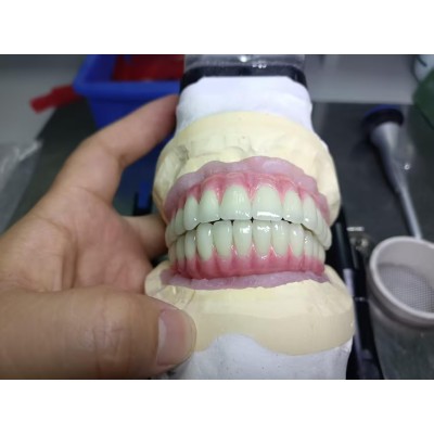 种植牙马龙桥生产厂家 （Maryland Bridge）图3