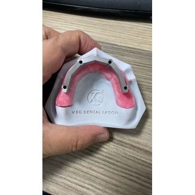 Full Denture Implants图4