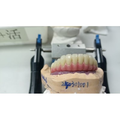 深圳种植牙外贸加工厂 种植牙公司出口图2